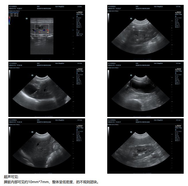 宠物狗狗年度体检,发现有脾脏结节