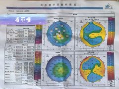 -美尔目眼科医院·近视手术·儿童近视(通州店)