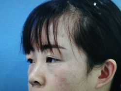 体验前-西安壹加壹医疗美容·西北抗衰旗舰店