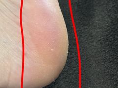 -郑远元专业修脚房(国顺东路店)