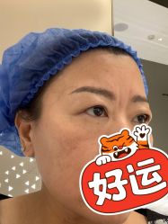 体验前-华臣医疗美容