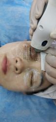 -小忠丽格医美