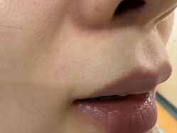 -安徽合肥韩美整形外科医院