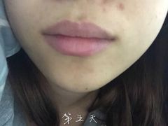-浙江大学医学院附属第二医院(解放路院区)