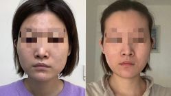 -CMS西美斯·美式医疗美容