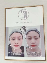 -白壁上妍の日式美肌·徒手小颜整骨院
