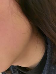 -四川米兰柏羽医学美容医院