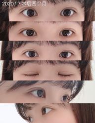 -成都西区医院整形美容
