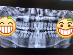 -欢乐口腔(望京分院)