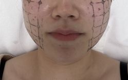 -深圳芙必优医疗美容·抗衰中心