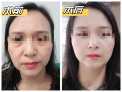 -素美医疗美容·西南眼鼻整形·修复基地