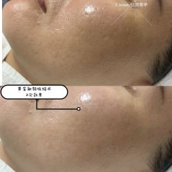 -E.beauty驻颜·痘敏肌调理中心