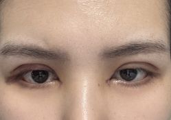 -JustHer宁波珈禾医疗美容医院