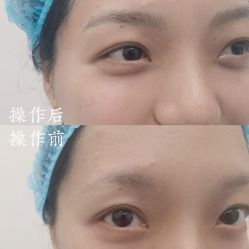 -西施无菌半永久纹绣眉眼影唇轻增发纹发际线
