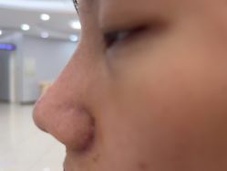 -广州美莱医疗美容医院