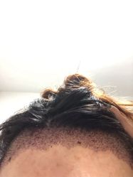 -雍禾植发全国连锁