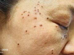 -复旦大学附属华山医院(总院)