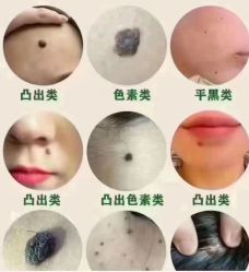 点击看大图 -玫莉蔻皮肤管理中心