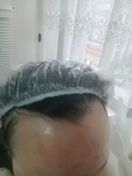 -长沙雅美医疗美容医院