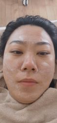 -苗方清颜•痘肌问题肌专研