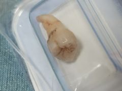 -Dr.Z dental仁康种植矫正中心