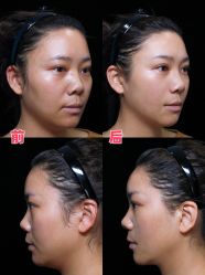 -深圳艺星医疗美容医院