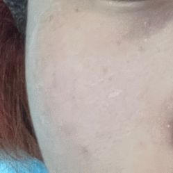 体验后-素美医疗美容·西南眼鼻整形·修复基地