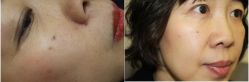 -丰联丽格医疗美容·联合丽格眼整形中心