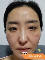 -小忠丽格医美