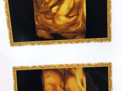 -伊丽莎白妇科医院·早孕检查