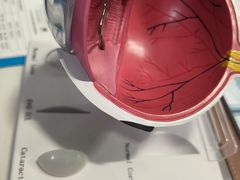 -西安普瑞眼科医院·近视手术·视力防控
