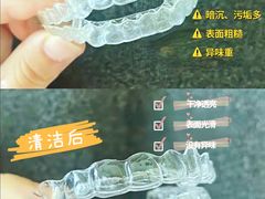 -团圆口腔·种植中心(锦江院区)