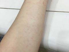 -上海市皮肤病医院(武夷路院区)