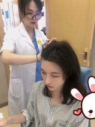 点击看大图 -大麦微针植发丨全国连锁