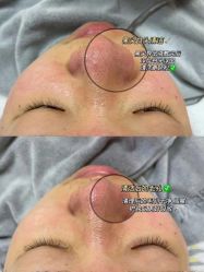 -+MS卓美丝专业祛痘·皮肤管理中心