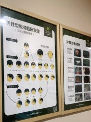 -丝客富脱发养发头皮馆