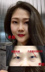 -丰联丽格医疗美容·联合丽格眼整形中心