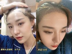 点击看大图 -熙朵美学植发连锁