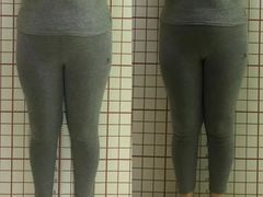 -修申骨雕小颜脊柱骨盆管理产后修复
