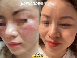 -元熙兰积皮肤管理