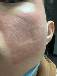 体验前-重庆军科整形美容医院