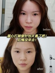 -深圳阳光医疗美容医院·旗舰店
