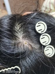 -清疣美疣·痣·斑净肤中心
