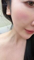 -海涛医疗美容·面部抗衰·注射美鼻