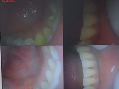 -深圳富茂格伦菲尔口腔门诊部(龙华清湖总院)