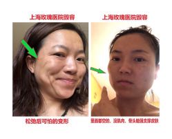 -上海玫瑰医疗美容医院