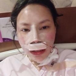 点击看大图 -厦门美莱整形美容医院