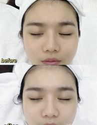 -SKIN79皮肤管理中心