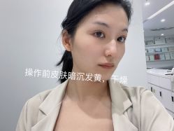 -慕颜医疗美容·皮肤微整 抗衰