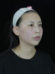 点击看大图 -Yestar重庆艺星医疗美容医院